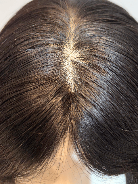 Luxury Silk Top Human Hair Wig – Most Natural Scalp Look